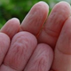 Illustration for article titled The reason for bathtime pruney-fingers and how to stop them